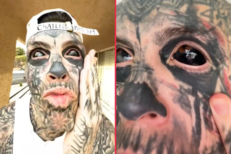 Tattoo obsessed TikToker spends thousands inking eyeballs black