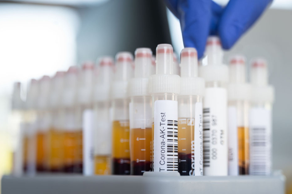 Die meisten der über 3300 Mitarbeitenden hat sich schon für einen Test angemeldet. (Symbolbild)