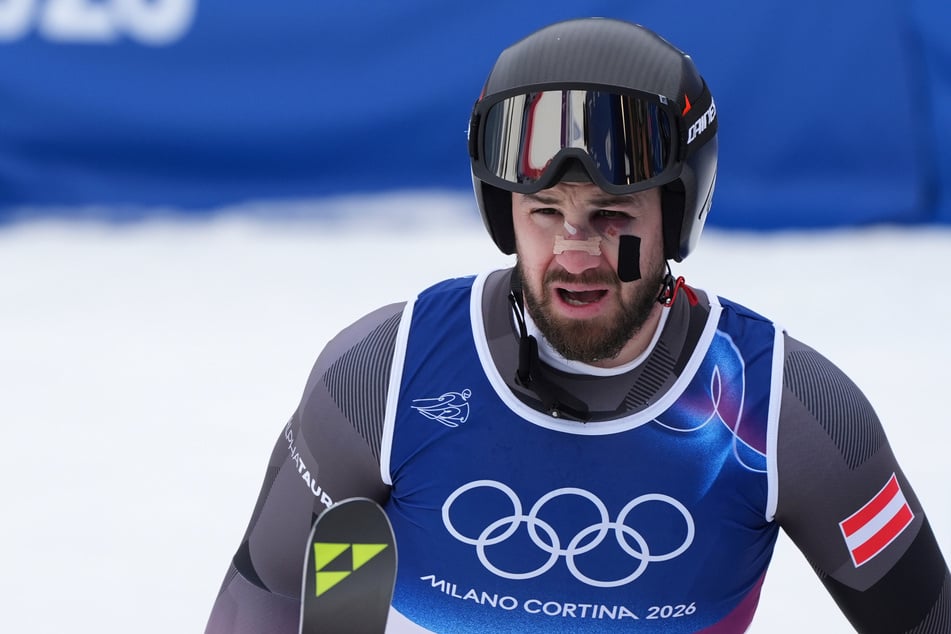 Mit geschundenem Gesicht kehrte Daniel Hemetsberger (34) am Tag nach seinem schweren Sturz auf die Piste zurück.