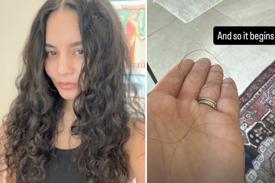Vanessa Hudgens (37) hat nach der Geburt ihres zweiten Kindes mit Haarausfall zu kämpfen.