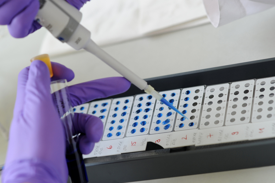 Ein Medizinisch Technischer Assistent detektiert im Hamburger Bernhard-Nocht-Institut für Tropenmedizin eine bereits abgeschlossene Antigen-Antikörper-Reaktion.