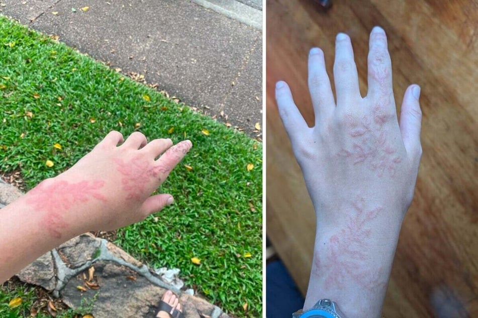 After a few days, the tattoo was very red.