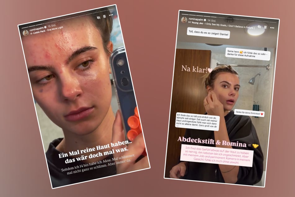 In ihrer Instagram-Story zeigt Influencerin Romina Palm (26) die Realität hinter Make-up und Filtern.