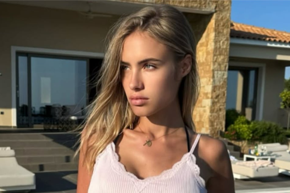 Alena Gerber (35) hat sich im Italienurlaub einen Finger gebrochen. Am meisten brachte das Model aber das Verhalten der Ärzte auf die Palme.