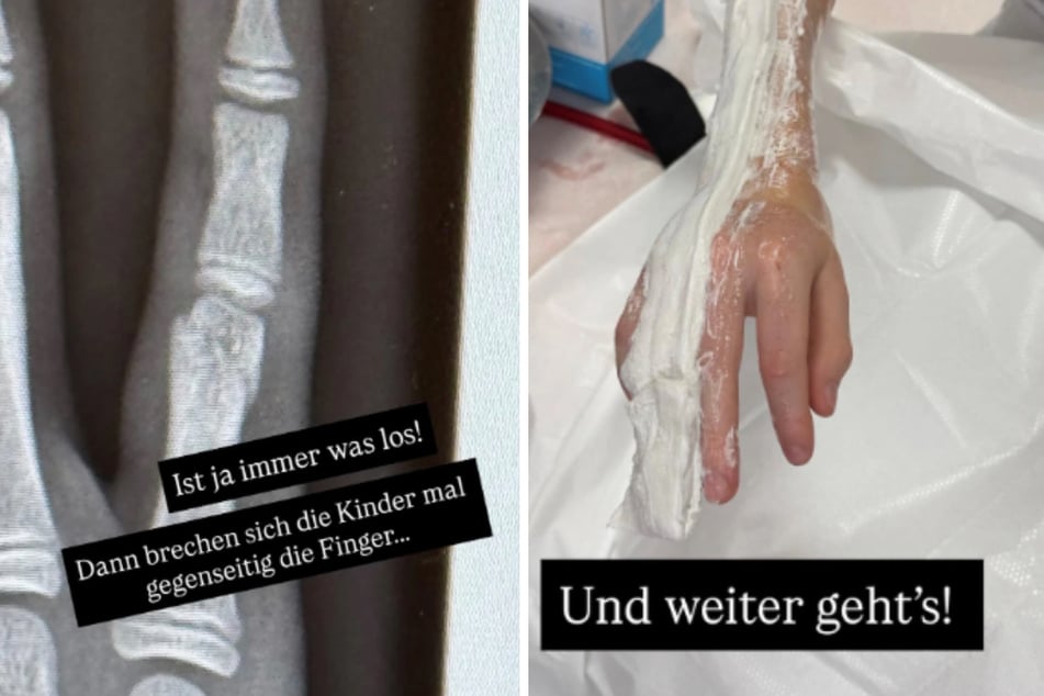 Oliver Pochers (48) 14 Jahre alter Zwillingssohn aus seiner ersten Ehe mit Sandy Meyer-Wölden (43) hat sich den Finger gebrochen.