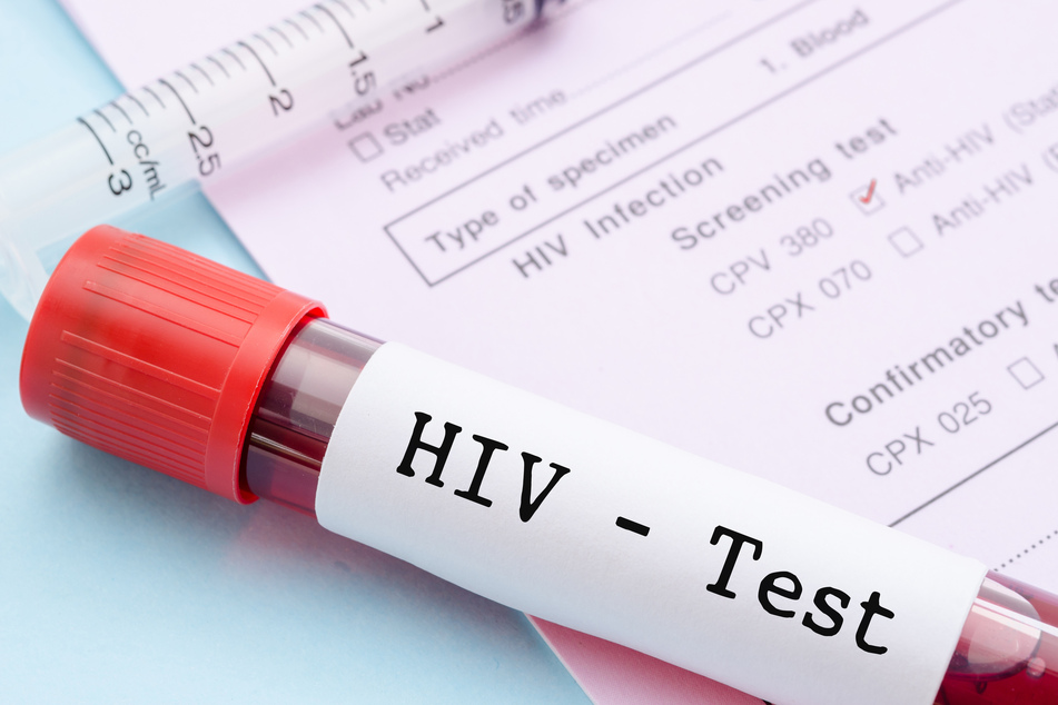 Blood collection tubes with HIV test label for HIV infection screening test form (symbol image)