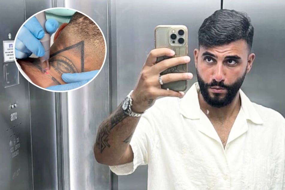 Samra lässt sich Tattoo-Sünde weglasern: "Ich war betrunken, durcheinander, wenig klar"