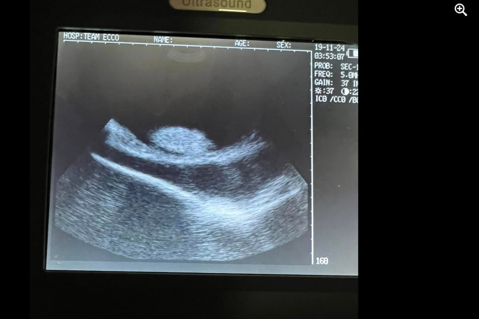 An ultrasound of the stingray appeared to show embryos.