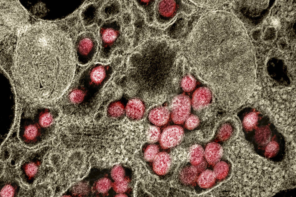 An image of several coronaviruses under an electron microscope.