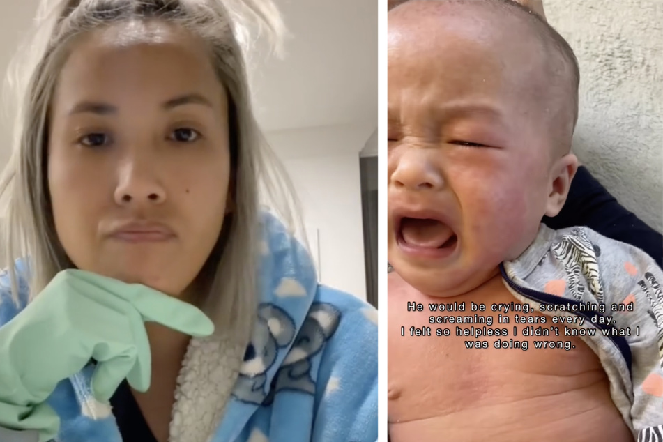 Mutter verzweifelt: Baby leidet plötzlich unter quälendem Ausschlag - die Lösung ist ihr zunächst unangenehm