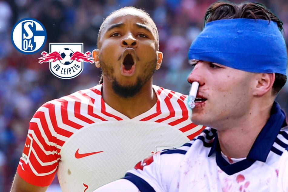 Harmlos, XXL-Verletztenliste, Dynamo-K.-o.: Gegen diese Truppe MUSS RB Leipzig einfach gewinnen