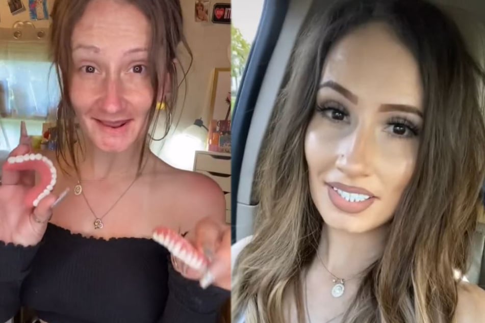 Frau zeigt sich ohne Make-up und mit falschen Zähnen: User sprachlos