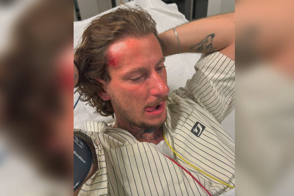 Auf Instagram teilte der Influencer auch ein Foto seines Bruders aus dem Krankenhaus.