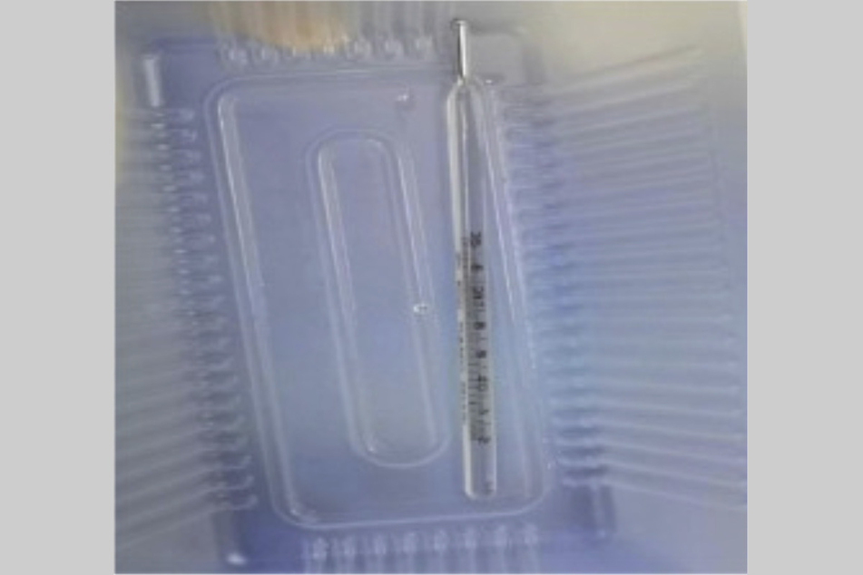 Dieses Thermometer hatten die Urologen aus dem Körper eines 12-jährigen Jungen entfernt.