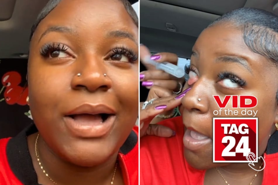 viral videos: Viral Video of the Day for July 16, 2024: Mom flushes out daughter's eye in hysterical viral TikTok!