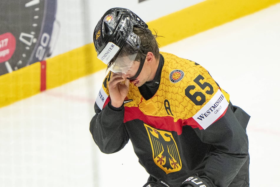 Marc Michaelis (29) musste im Spiel gegen Dänemark blutend vom Eis.