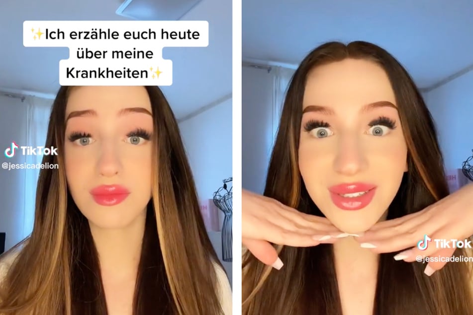 Die ehemalige "Love Island"-Kandidatin Jessica D. (23) wandte sich an ihre mehr als 341.000 TikTok-Follower, um von ihren Krankheiten zu berichten.