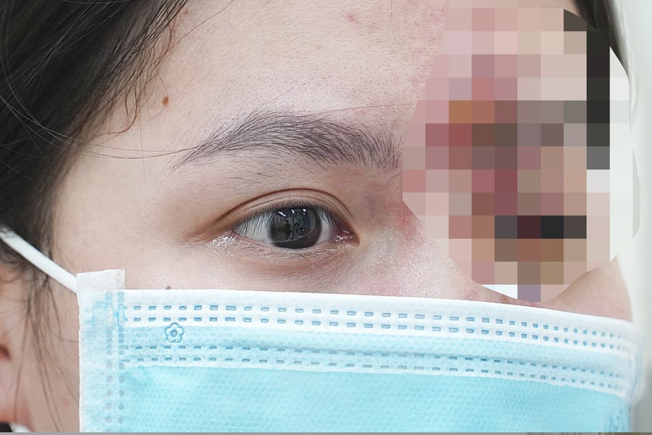 Schock nach Beauty-Behandlung: 17-Jährige erblindet auf einem Auge