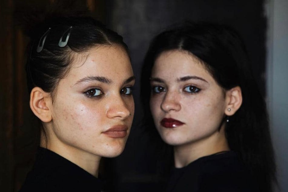 Die eineigen Zwillinge Amy Khvitia und Ano Sartania (beide 21) wurden als Babys getrennt.