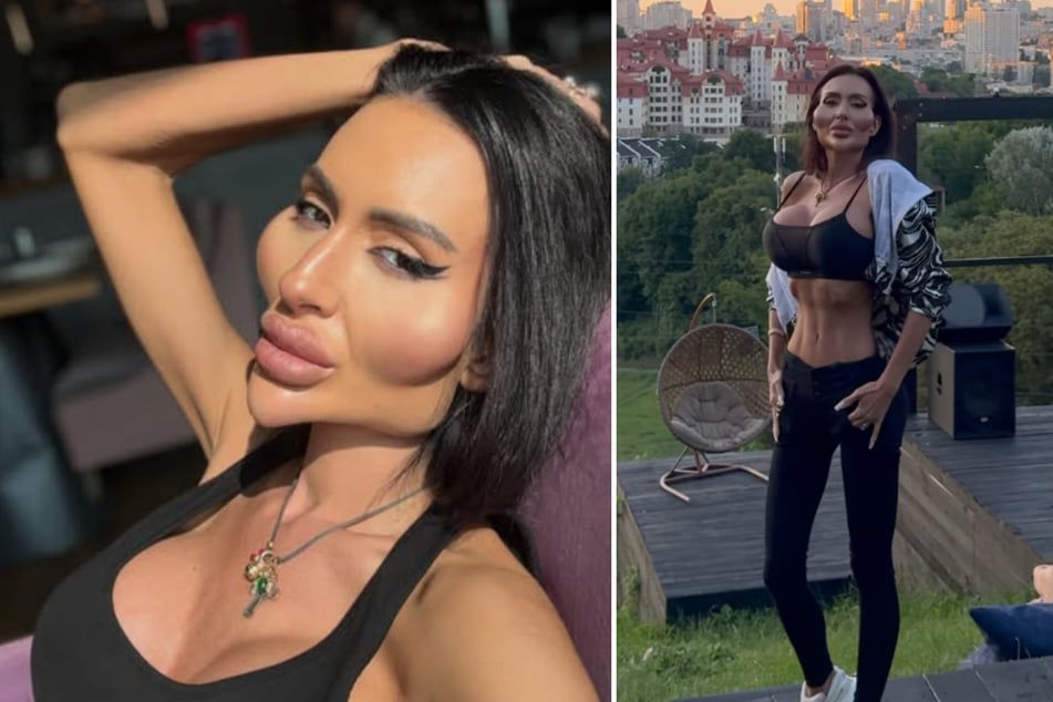 Anastasia Pokreshchuk (36) rühmt sich mit den "größten Wangen der Welt", nachdem sie in Filler und andere Beautyeingriffe investiert hat.