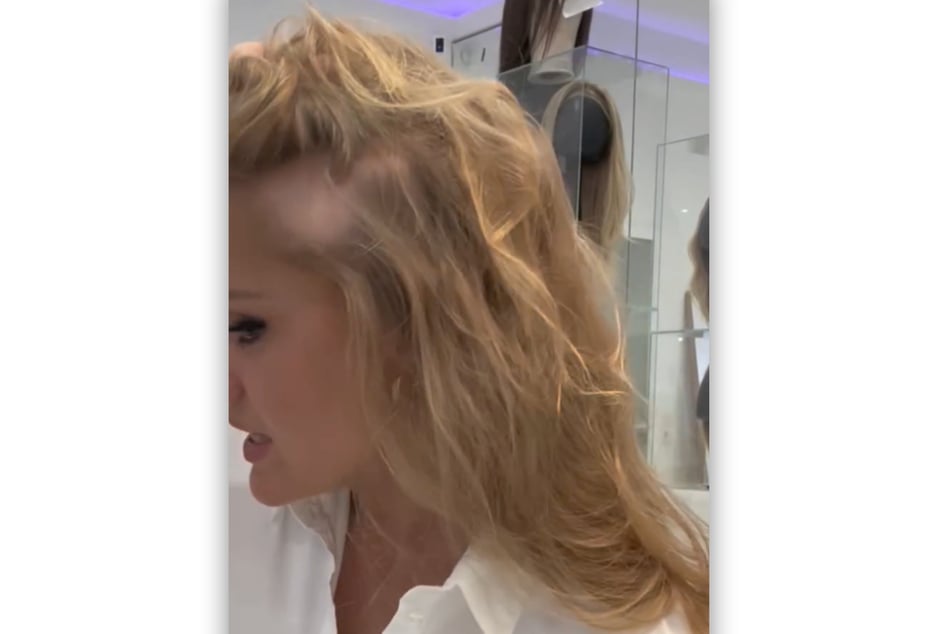 Trotz des Haarausfalls lässt sich Patrice Aminati (30) nicht unterkriegen.
