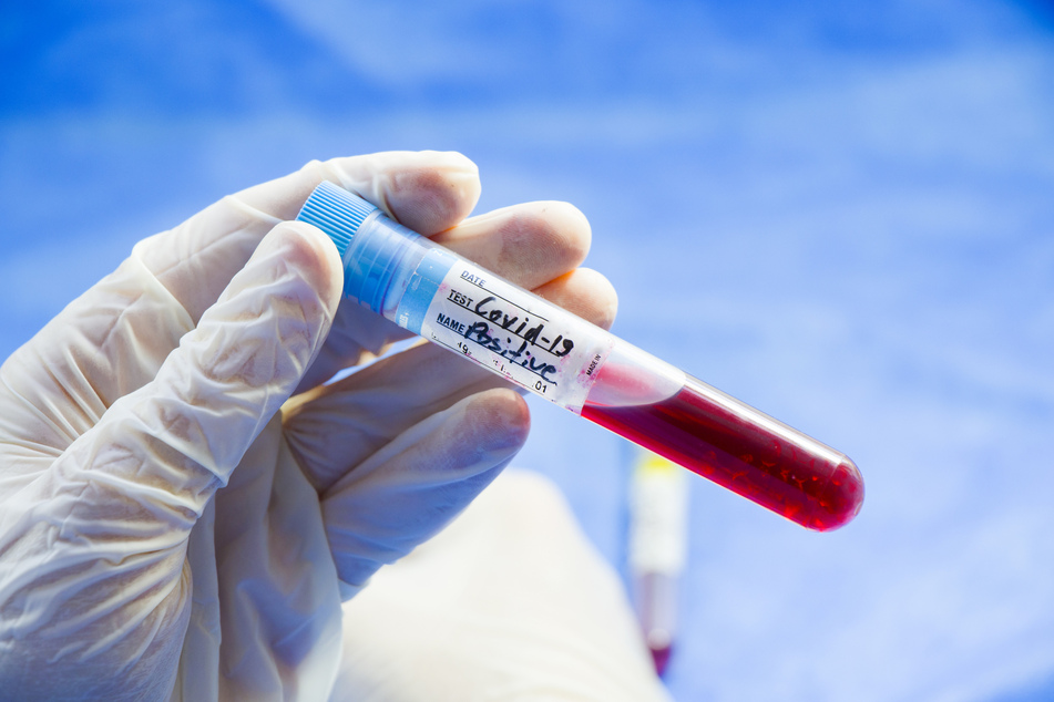 Experten rechnen mit einer breiten Verfügbarkeit geeigneter Impfstoffe gegen das Coronavirus erst im kommenden Jahr. (Symbolbild)
