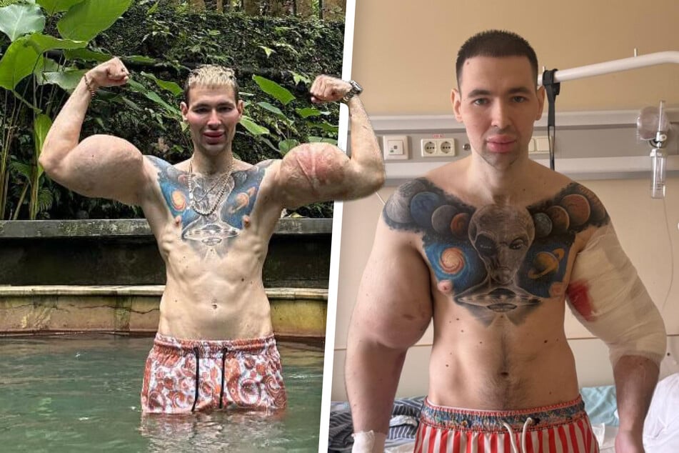 "Russischer Popeye" mit Öl im Bizeps muss in Klinik! Hat er endlich aus seinen Fehlern gelernt?