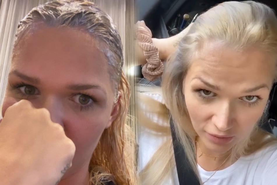 "Allergischer Schock" beim Friseur: Sind Sara Kulkas Haare noch zu retten?