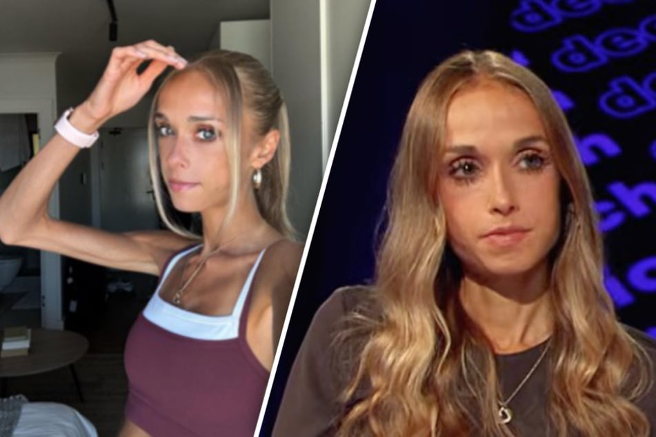 Ärztin gab ihr noch zwei Wochen: Influencerin kämpft seit 13. Lebensjahr gegen Magersucht