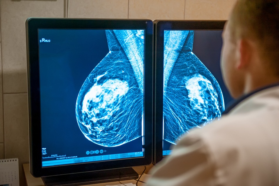 AI could help solve the shortage of radiologists in many countries, including in the US.