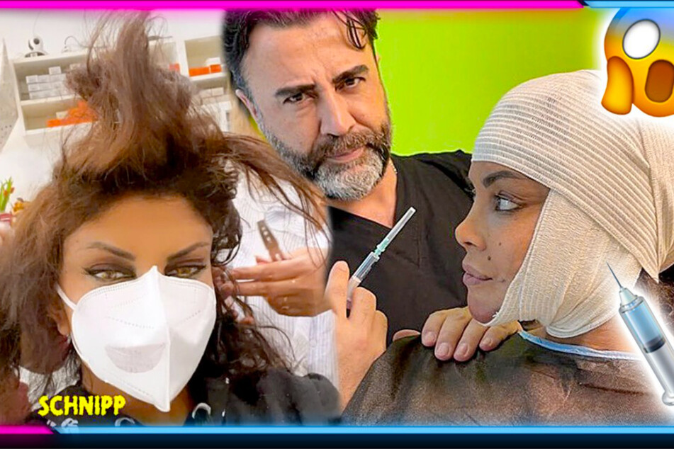 Extrem-Makeover! Musste sich Kader Loth wegen TV-Show unters Messer legen?