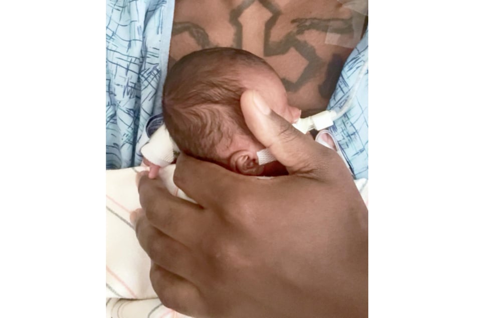 Jonah ist derzeit noch auf der Neugeborenen-Intensivstation.