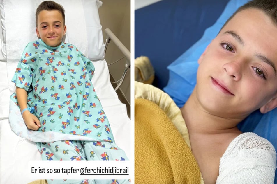 Der Elfjährige musste nach dem Unfall Anfang Juni mit 17 Stichen genäht werden. (Archivbild)