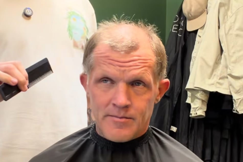 Matt (47) hat große Probleme mit seinem Haarausfall.