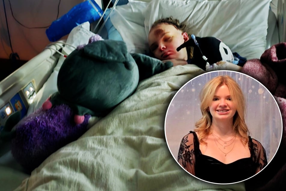 Heftiger E-Bike-Crash: Mädchen rast mit 60 km/h gegen Mauer