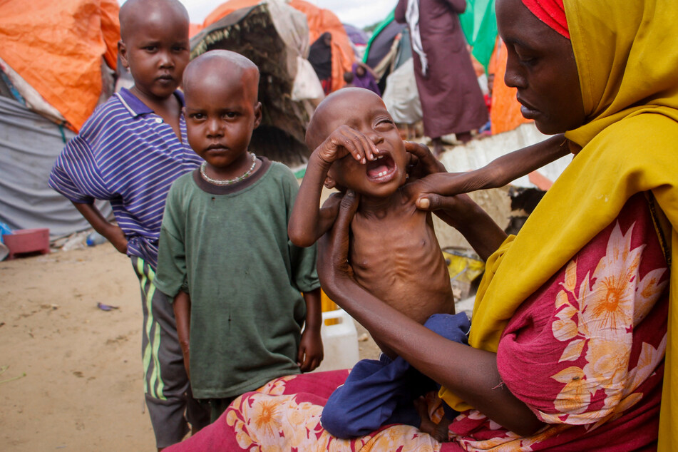 Horror-Hungersnot in Somalia: Selbst zum Weinen fehlt die Kraft