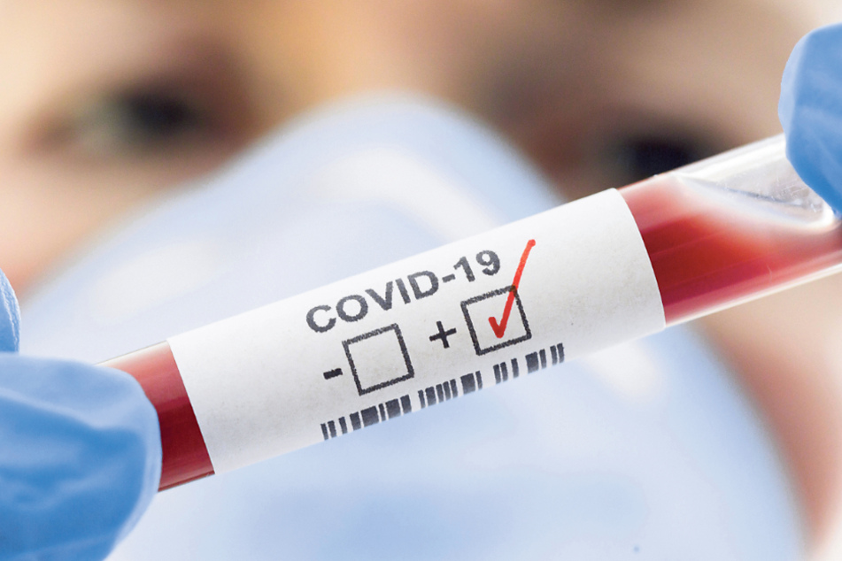 Leider positiv: Eine Probe mit Corona-Viren.