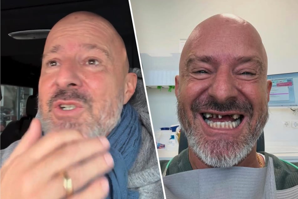 Spott wegen fehlender Zähne: Reality-Star von Reaktionen "erschüttert"