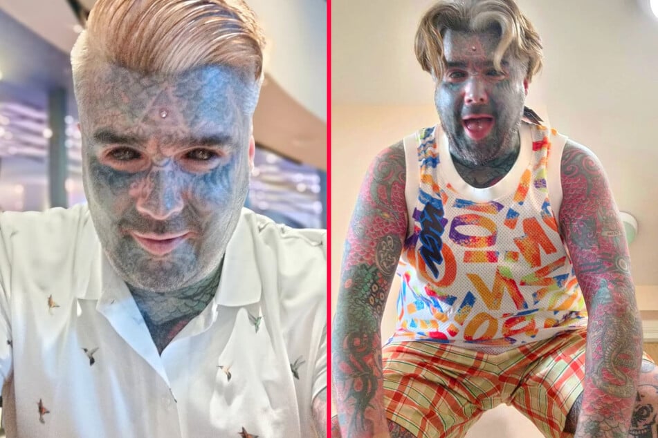 This UK man needs medical help to remove rotting body modifications.