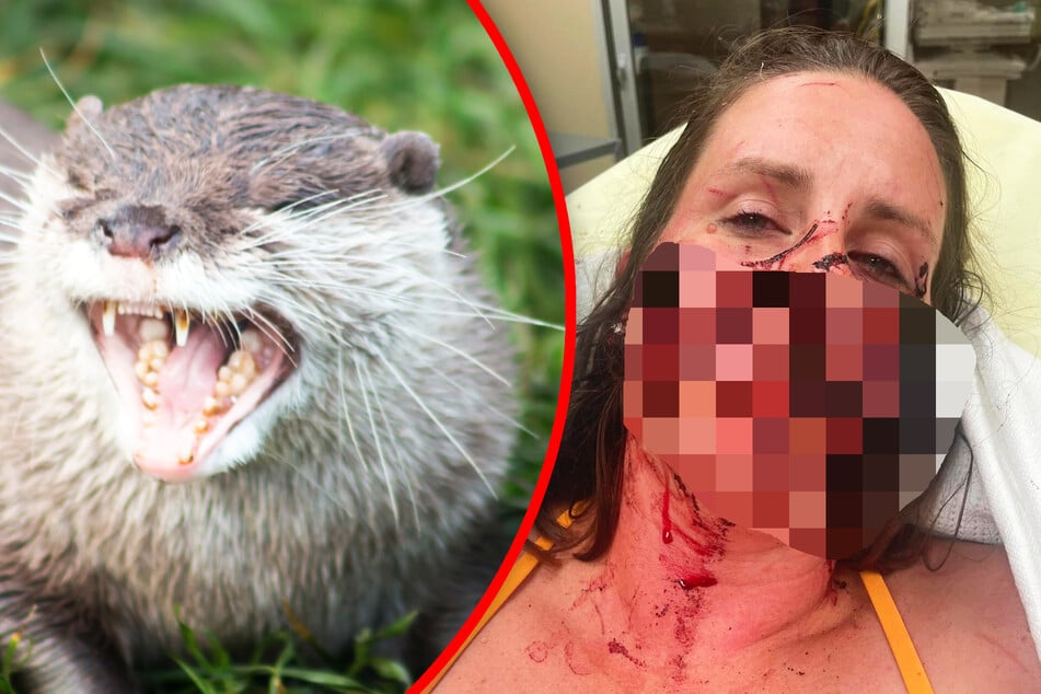 Biss-Spuren am ganzen Körper: Aggressiver Otter greift Frauen auf Schlauchboot an!