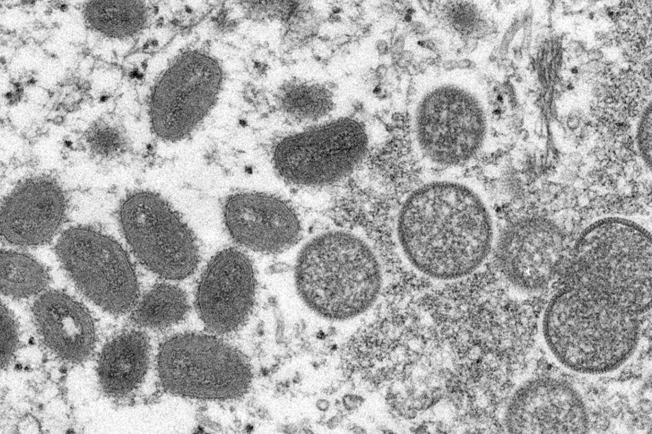 So sehen Affenpocken-Viren unter dem Mikroskop aus.