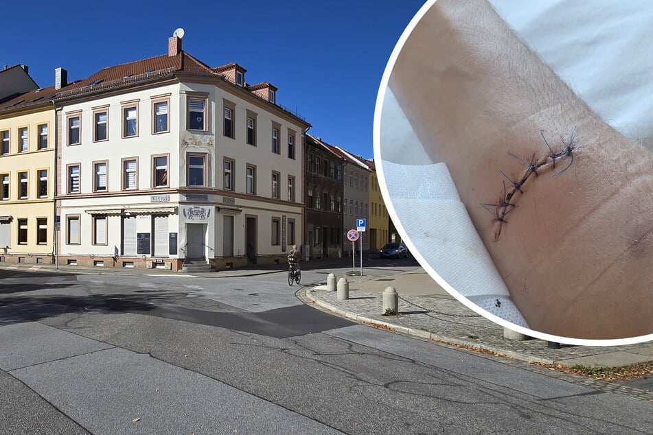 Messerattacke: Messerstecherei in Bautzen: Mann erleidet Stichwunden an Arm und Hals