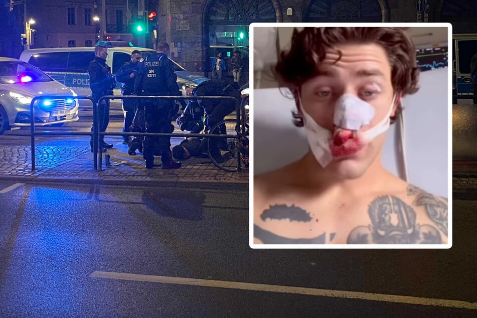 Dresden: Amerikaner (21) will Frauen helfen und wird brutal mit Messer attackiert! Täter noch immer flüchtig