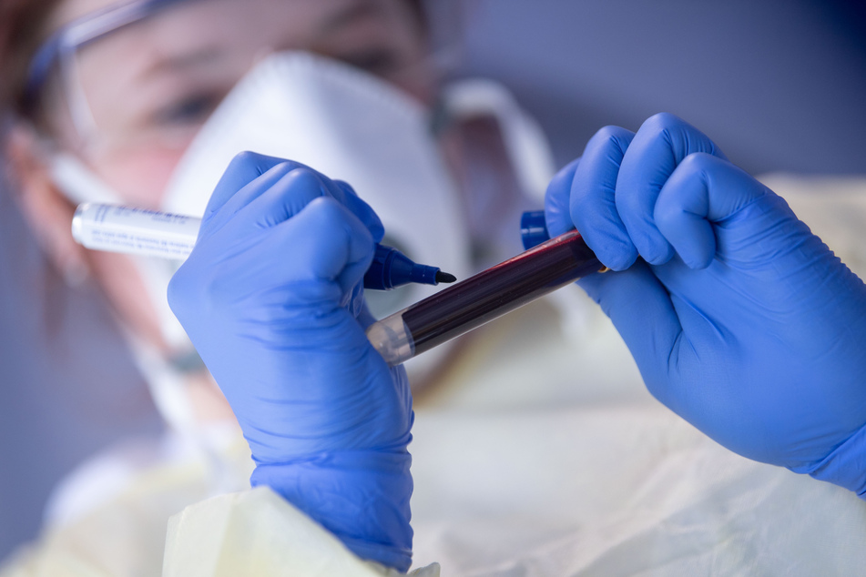 Ein Mitarbeiterin des Robert Koch-Instituts (RKI) beschriftet während eines Fototermins nach einer Pressekonferenz zum Start der Studie "Corona-Monitoring lokal" eine Blutprobe für einen Antikörpertest.