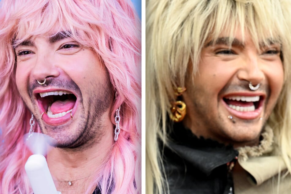 So stark wurden Bills Zähne angepasst.