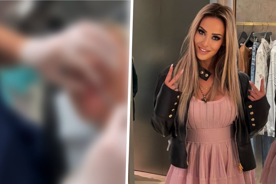 Gesicht entstellt: Plötzlich meldet sich Cora Schumacher blutverschmiert aus der Notaufnahme