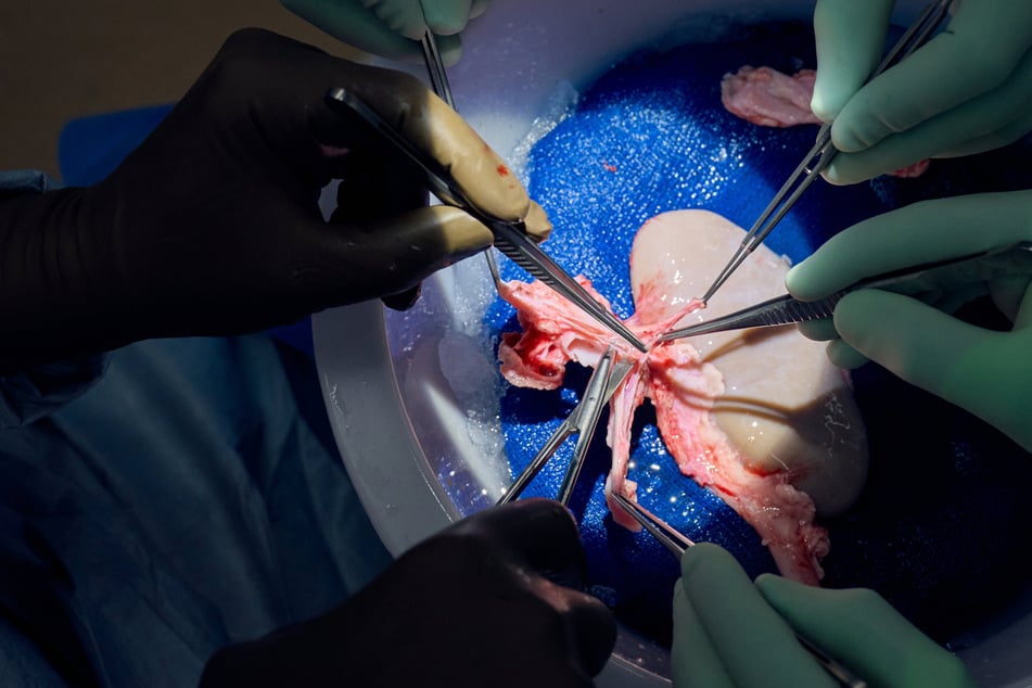 A pig kidney transplanted into a brain-dead patient is still functional after more than a month, surgeons said.