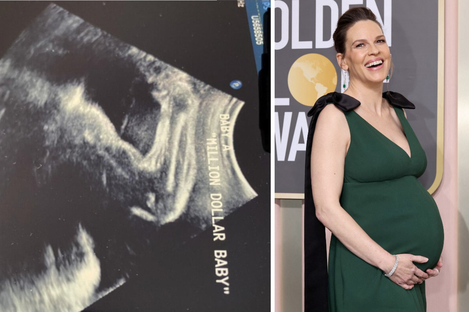 Hilary Swank shares ultrasound image of her real-life Million Dollar Baby