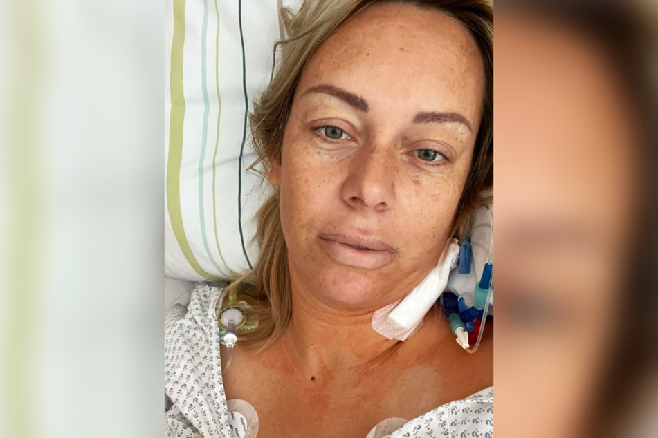 Die krebskranke Influencerin Julia Holz (35) unterzieht sich aktuell einer Chemotherapie.