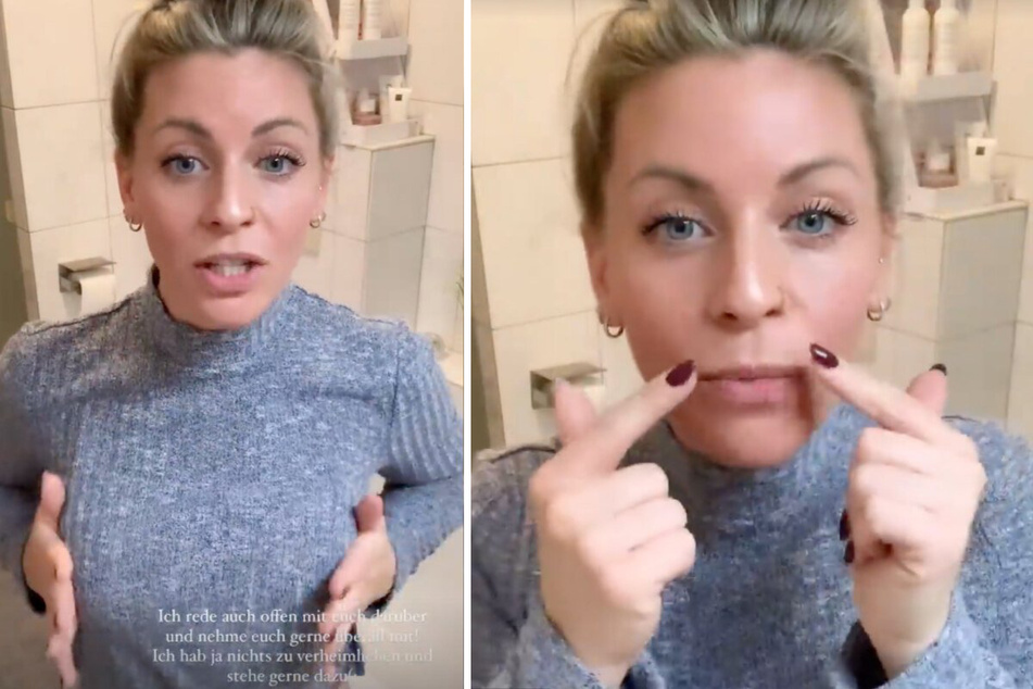 Sabrina (28) ließ sich bereits die Brüste vergrößern, jetzt will sie auch eine Veränderung im Gesicht.